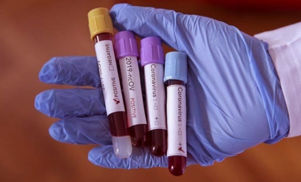 वडा नम्बर ९ मा ९ !