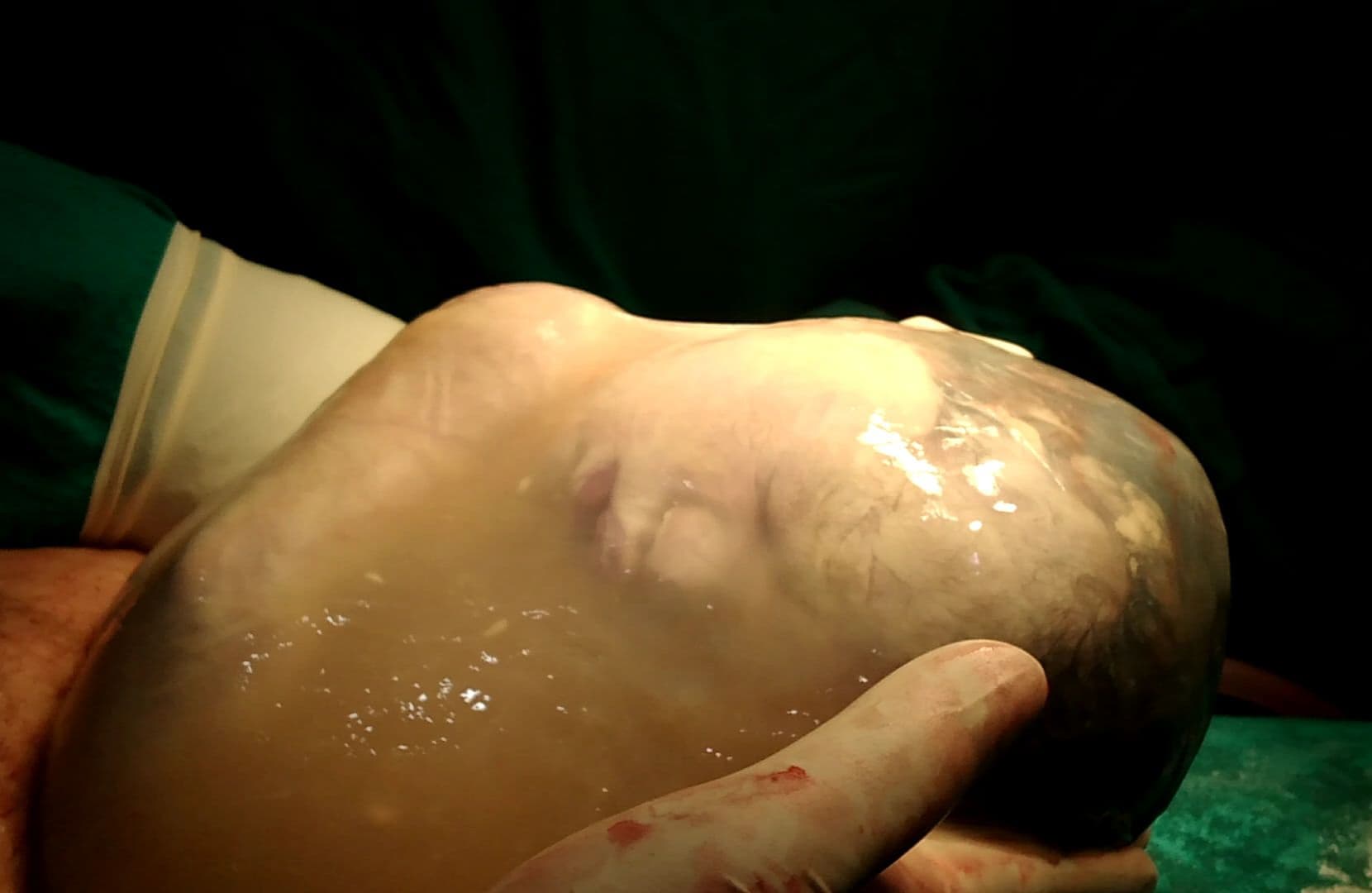 डडेल्धुरामा इन काउलसहित बच्चा जन्मियो